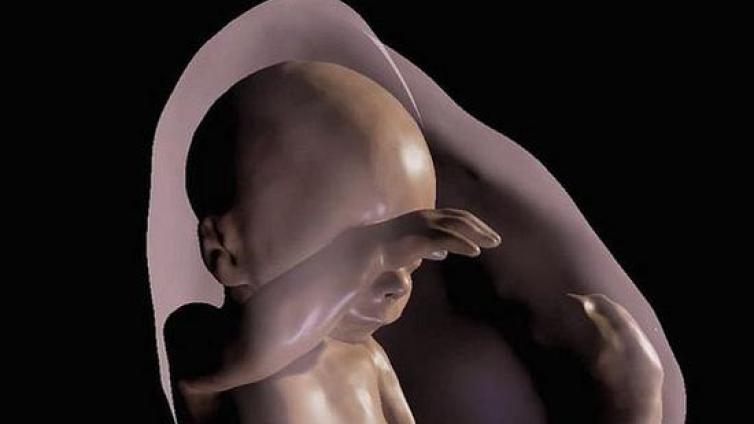 VR与磁共振相结合 让准爸妈亲眼看到未出生的宝宝